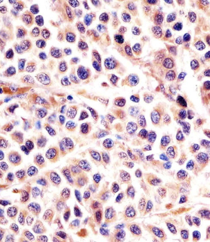 IL24 Antibody