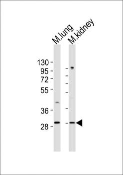 Mouse Hoxb4 Antibody (C-term)