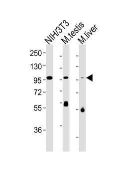 Fer Antibody
