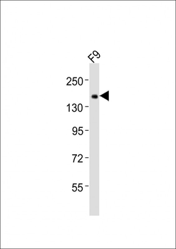 (Mouse) Tet1 Antibody (C-term)