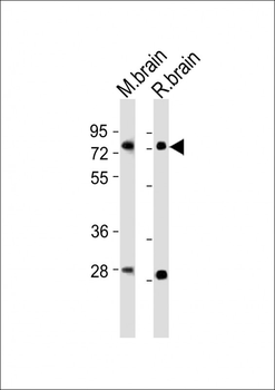 (Mouse) Nr4a2 Antibody (Center)