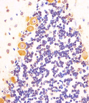 (Mouse) Shh Antibody (N-term)