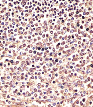 PSMB9 Antibody (C-term)