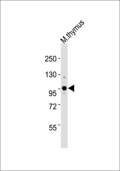 (Mouse) Uhrf1 Antibody (C-term)