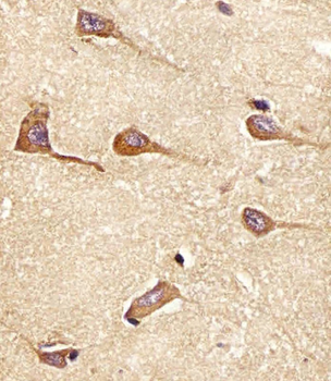 AMPH Antibody (Center)