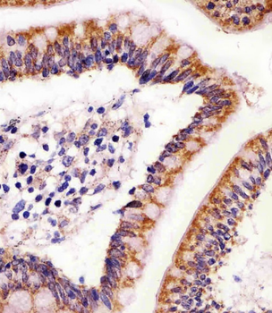 ABL2 Antibody