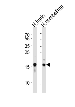 SNCA Antibody (C-term)