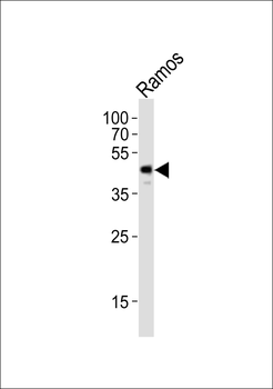 CSK Antibody (Center)