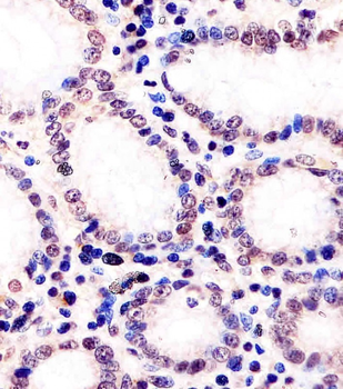 (Mouse) Dnmt1 Antibody (Center)