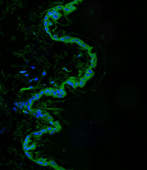 Mouse Srms Antibody (Center)