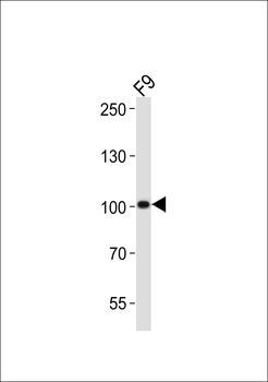 (Mouse) Suz12 Antibody (Center)