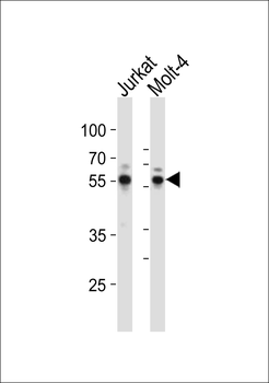 RUNX1 Antibody (C-term)