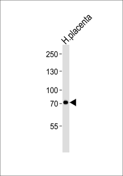 CAPN6 Antibody