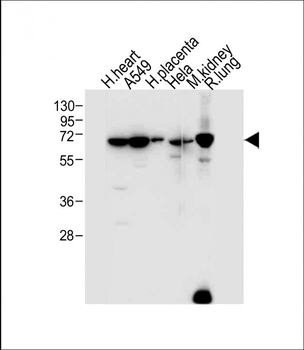 EHD2 Antibody (C-term)