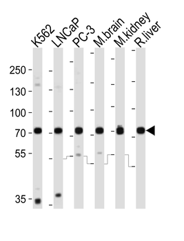 CD164 Antibody (C-term)