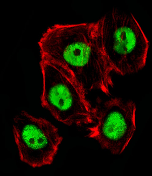 Mouse Ctr9 Antibody (C-term)