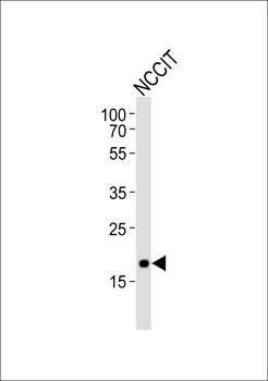 Mouse Hmga2 Antibody (N-term)
