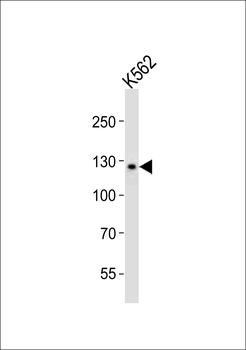 LIFR Antibody (C-term)