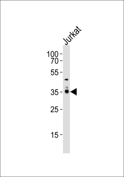 PPAP2A Antibody (C-term)