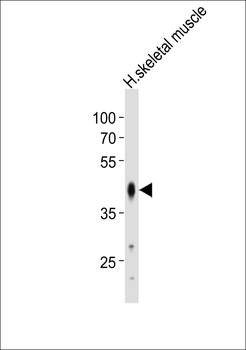 POU5F1B Antibody (N-term)