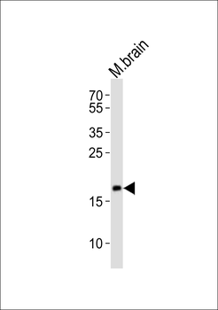 FAM168B Antibody (C-term)