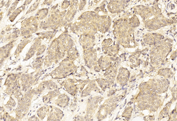 ERBB2 Antibody