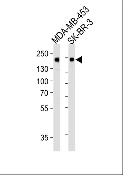 ERBB2 Antibody