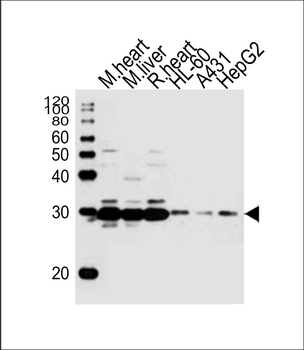 SDHB Antibody