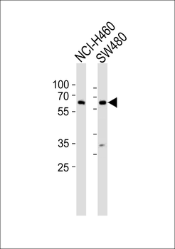 PPP2R1B Antibody (N-term)