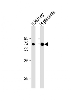 EPOR Antibody (C-term)