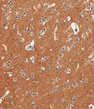 NCAM1 Antibody (C-term)