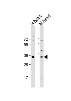 Mouse Nkx2-5 Antibody (Center)