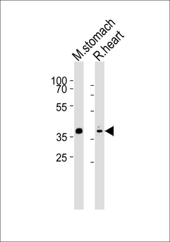Mouse Nkx2-5 Antibody (Center)