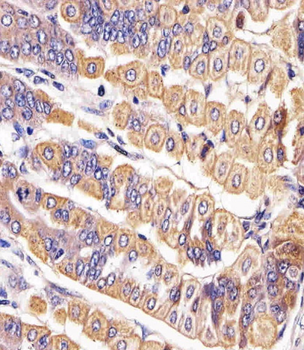 Mouse Ror2 Antibody (C-term)