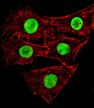 Mouse Hmga2 Antibody (C-term)