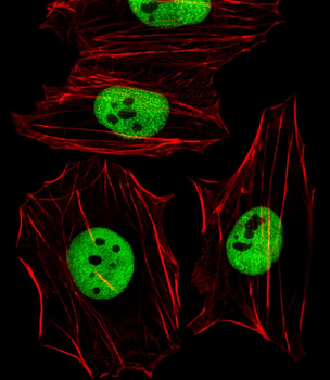 (Mouse) Smarcc1 Antibody (C-term)