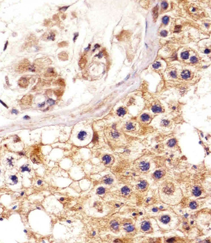 EPHA4 Antibody (Center)