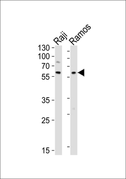 LYN Antibody (N-term)