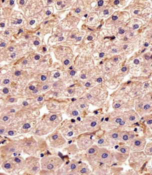 STMN2 Antibody (N-term)