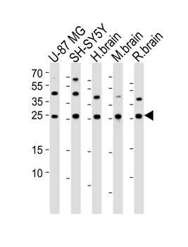 STMN2 Antibody (N-term)