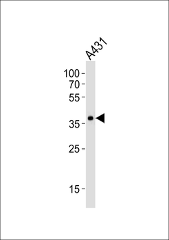 MUL1 Antibody (Center)