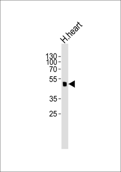 SLC2A4 Antibody (C-term)