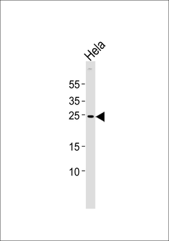 ZNRF2 Antibody (N-term)