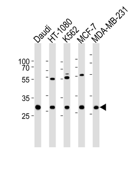 PNP Antibody (Center)