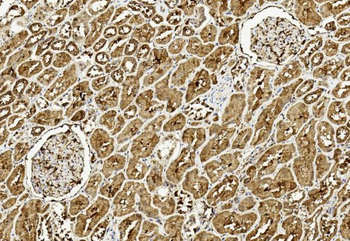 ULK3 Antibody (C-term)
