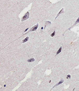 PTK2B Antibody (C-term)