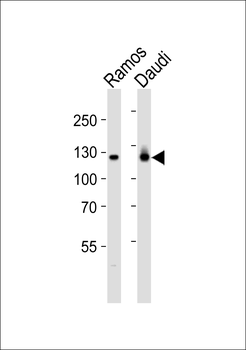PTK2B Antibody (C-term)