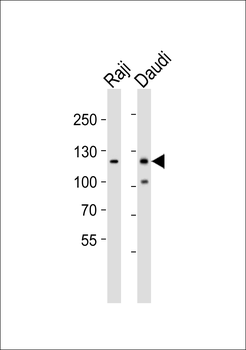 PTK2B Antibody (C-term)