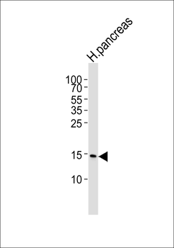 REG3A Antibody (Center)