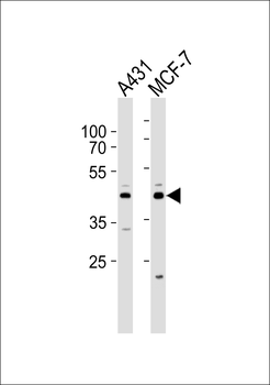 IDH3G Antibody (N-term)